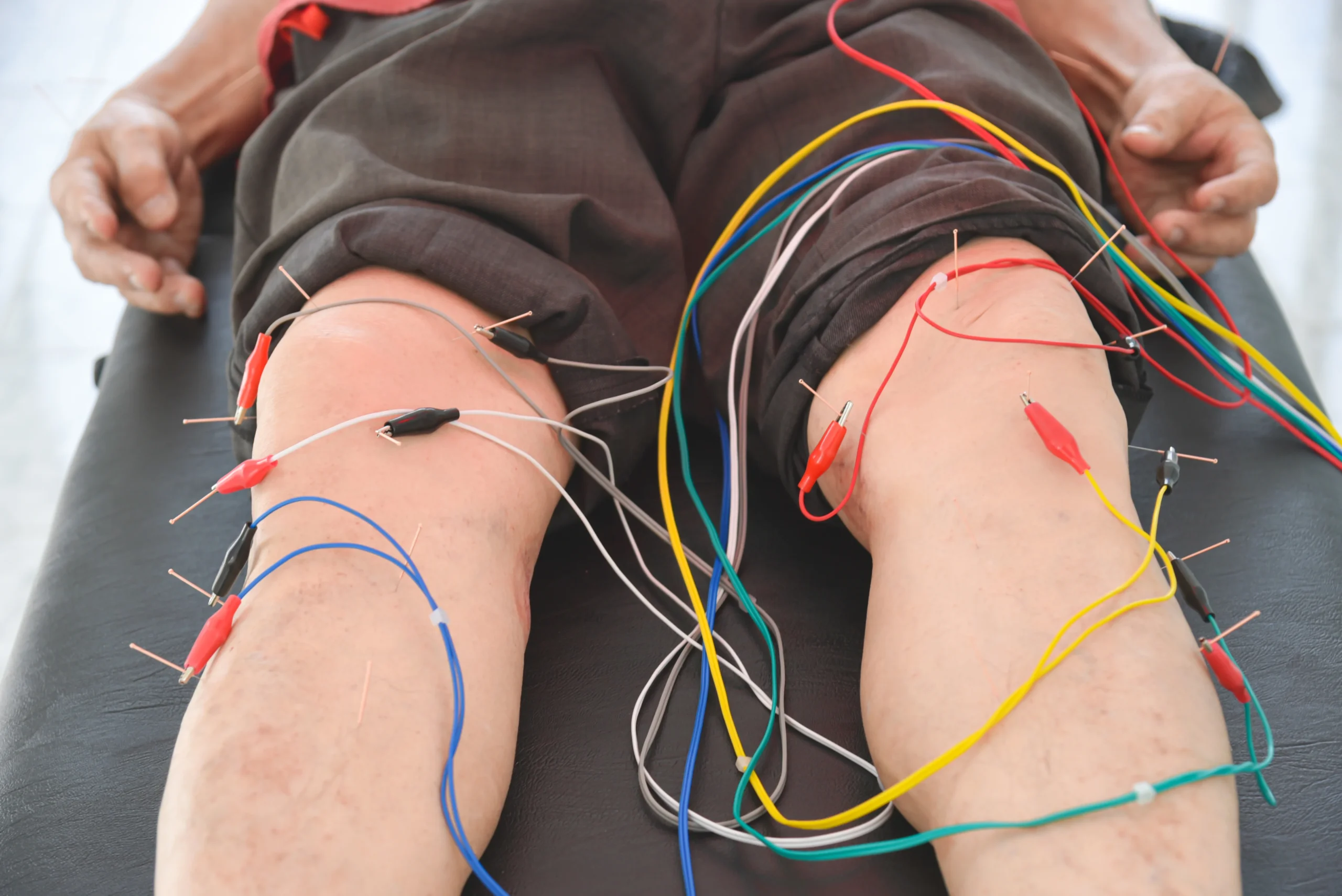 Sciatica & nerve compression
